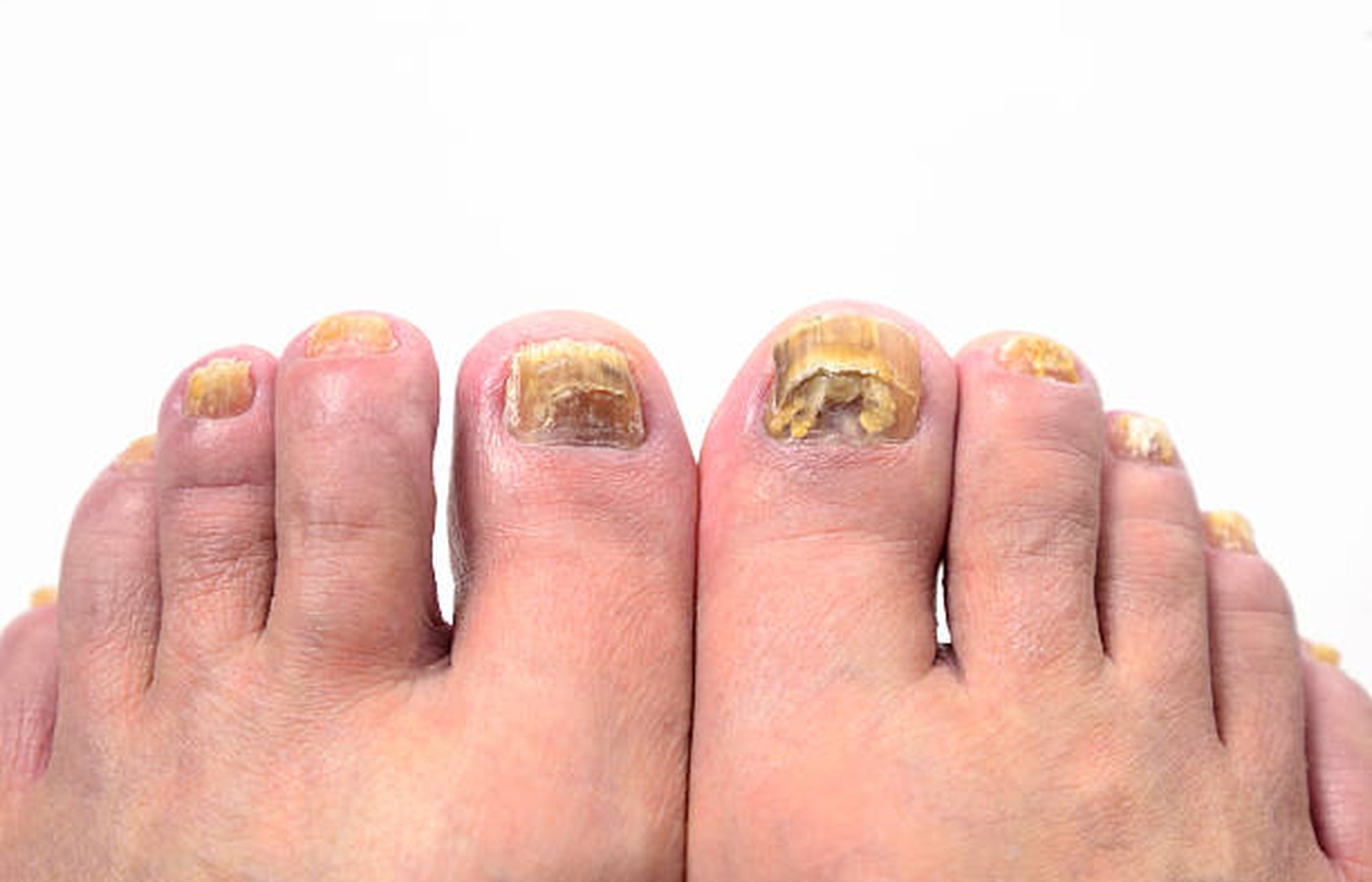 Foot & Nail Care