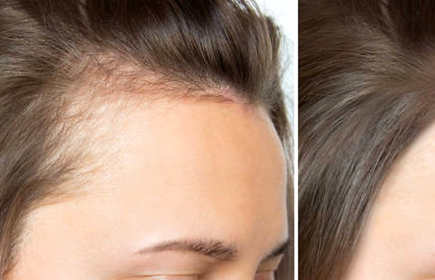 Hair & Scalp